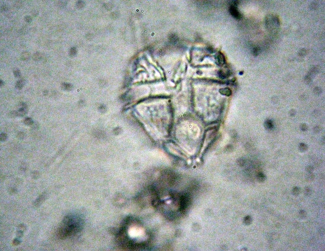 Identificazione di un dinoflagellato